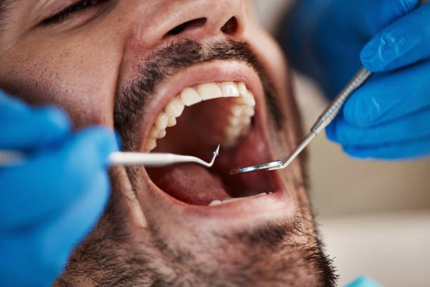 Best Same-Day Emergency Dental Services in Houserville, PA