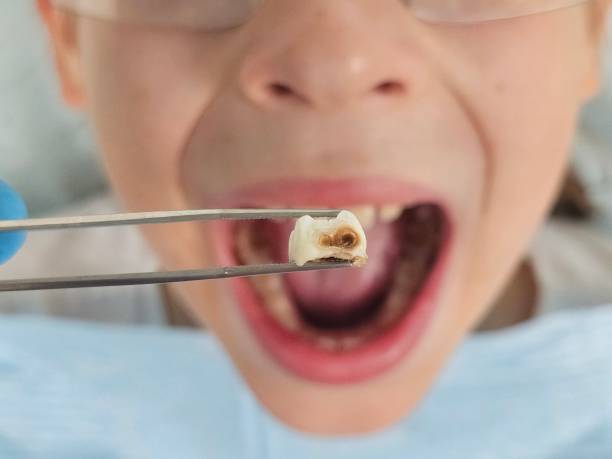Best Weekend Emergency Dentist in Houserville, PA