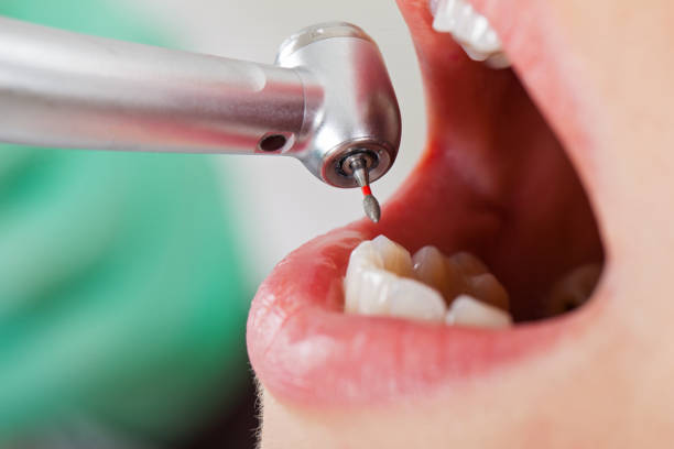 Best Emergency Gum Treatment in Houserville, PA